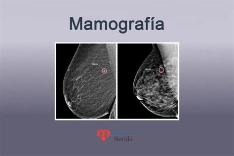 mamografia normal e com cancer - frases sobre natureza e deus